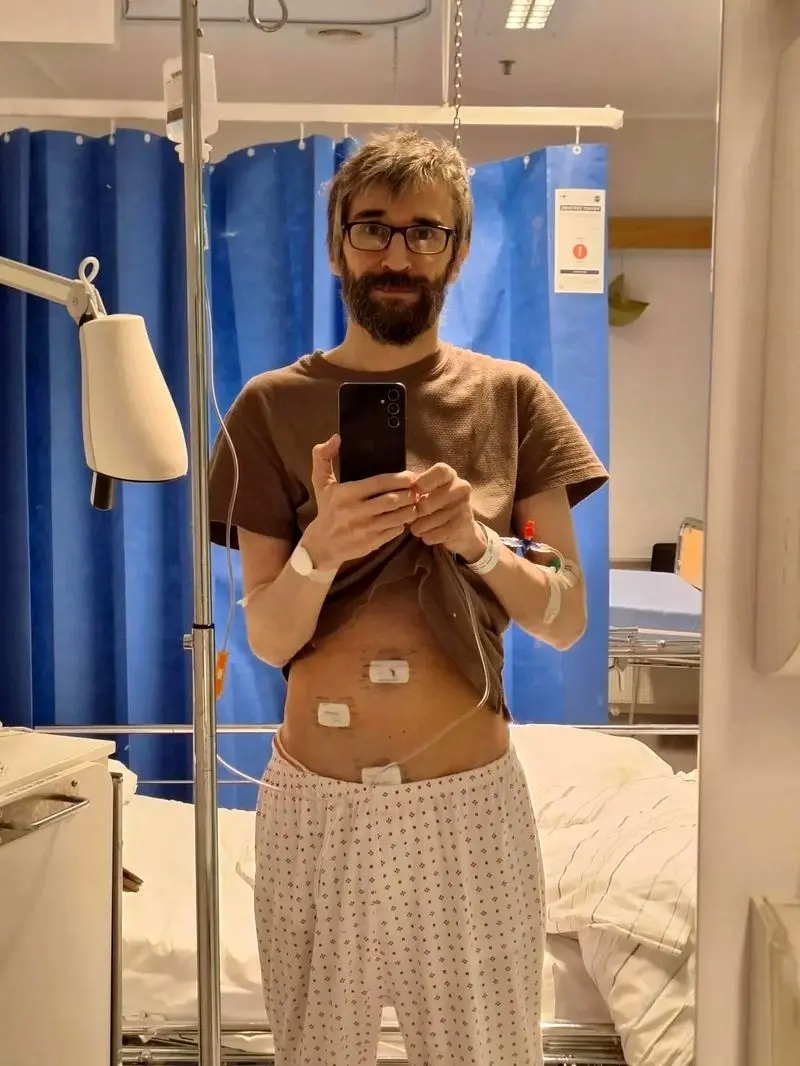 هوش مصنوعی با تشخیص آپاندیس جان مردی را از مرگ نجات داد